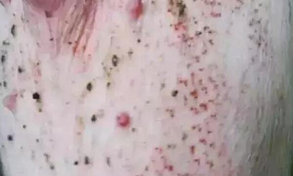 夏天猪皮肤有红点，可能是这4种疾病 如何轻松区分和诊治？